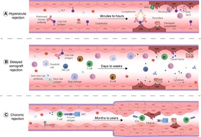 Current status of xenotransplantation research and the strategies for preventing xenograft rejection